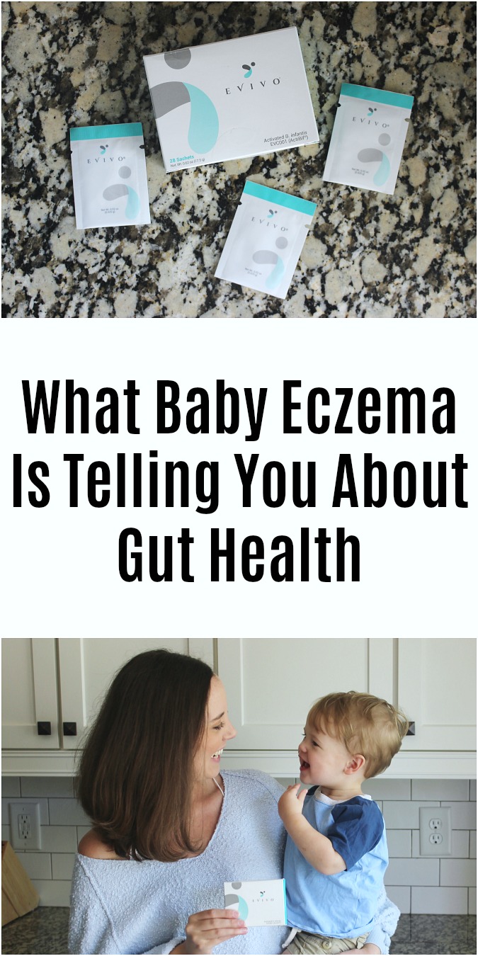 What Baby Eczema Is Telling You About Gut Health